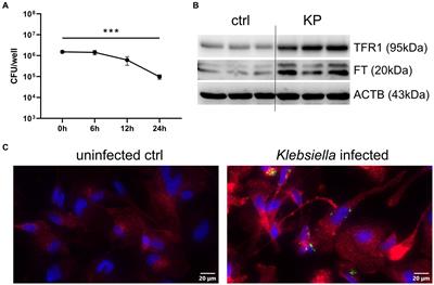 Klebsiella pneumoniae manipulates human macrophages to acquire iron